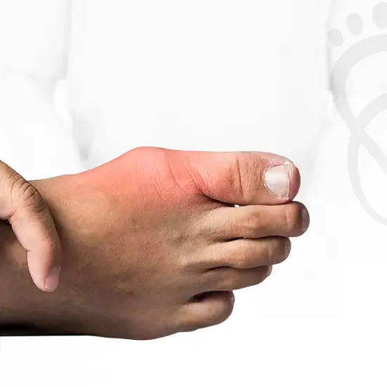 dr. fernando alvo tratamentos e cirugias cirurgia hálux rígido