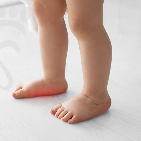 dr. fernando alvo tratamentos e cirugias pé plano infantil